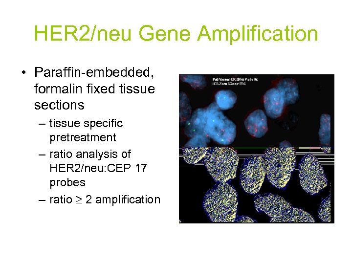 HER 2/neu Gene Amplification • Paraffin-embedded, formalin fixed tissue sections – tissue specific pretreatment