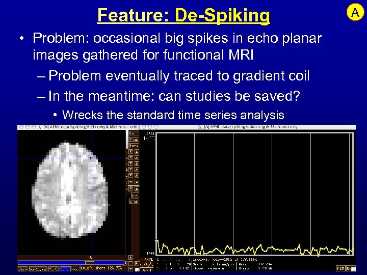 Feature: De-Spiking • Problem: occasional big spikes in echo planar images gathered for functional