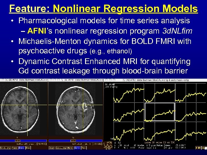 Feature: Nonlinear Regression Models • Pharmacological models for time series analysis – AFNI’s nonlinear