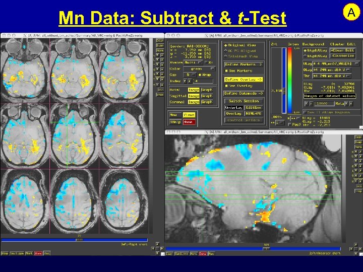 Mn Data: Subtract & t-Test A 