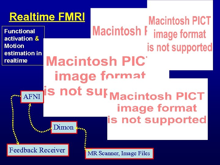 Realtime FMRI Functional activation & Motion estimation in realtime AFNI Dimon Feedback Receiver MR