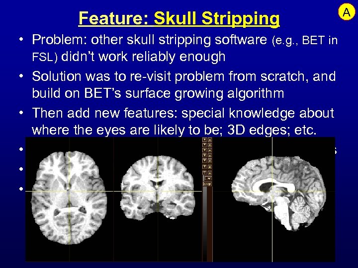 Feature: Skull Stripping • Problem: other skull stripping software (e. g. , BET in