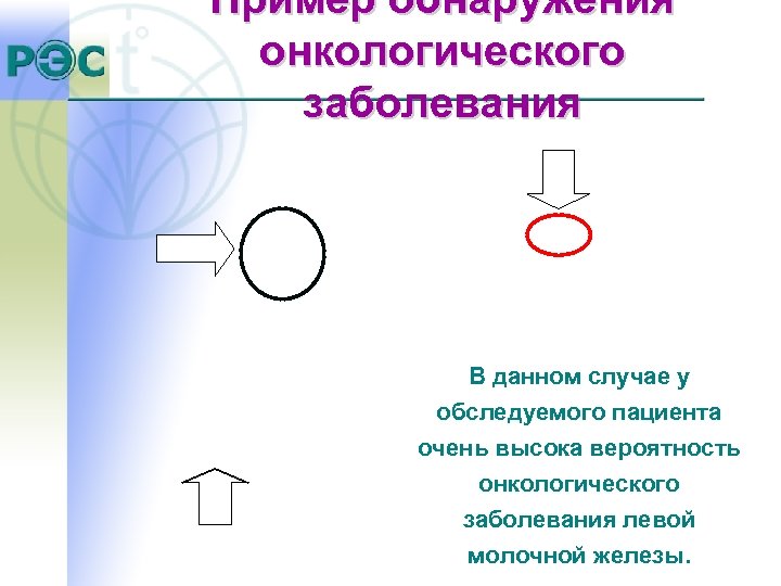 Пример обнаружения онкологического заболевания В данном случае у обследуемого пациента очень высока вероятность онкологического