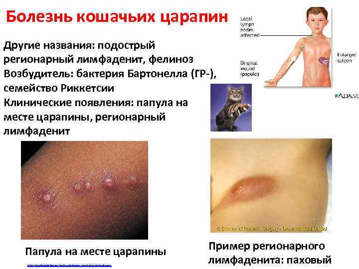 Болезнь кошачьих царапин Другие названия: подострый регионарный лимфаденит, фелиноз Возбудитель: бактерия Бартонелла (ГР-), семейство
