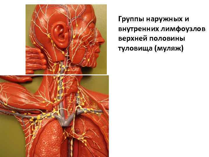 Группы наружных и внутренних лимфоузлов верхней половины туловища (муляж) 