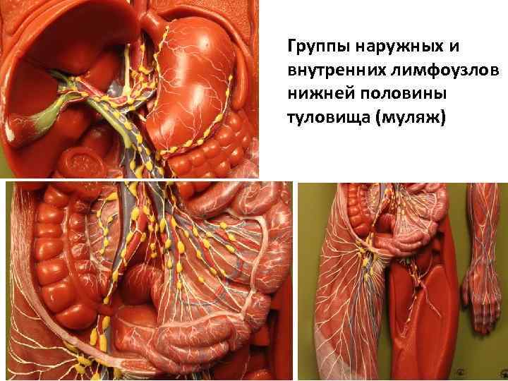 Группы наружных и внутренних лимфоузлов нижней половины туловища (муляж) 