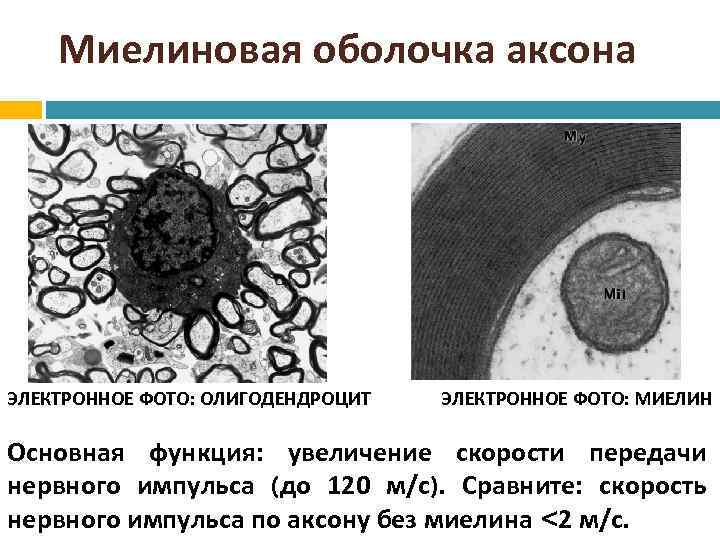 Миелиновая оболочка аксона ЭЛЕКТРОННОЕ ФОТО: ОЛИГОДЕНДРОЦИТ ЭЛЕКТРОННОЕ ФОТО: МИЕЛИН Основная функция: увеличение скорости передачи