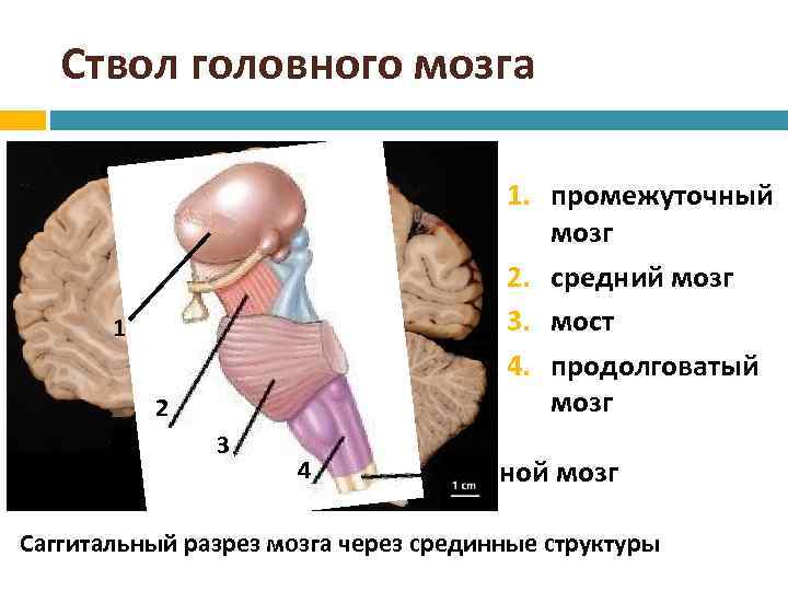 Ствол головного мозга 1 1 1. промежуточный мозг 2. средний мозг 3. мост 4.