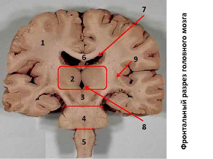 1 6 4 5 9 2 3 8 Фронтальный разрез головного мозга 7 