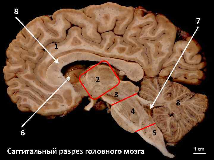 8 7 1 2 3 8 4 6 Саггитальный разрез головного мозга 5 