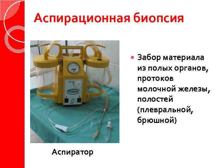 Аспирационная биопсия Аспиратор Забор материала из полых органов, протоков молочной железы, полостей (плевральной, брюшной)