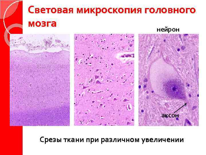 Световая микроскопия головного мозга нейрон аксон Срезы ткани при различном увеличении 
