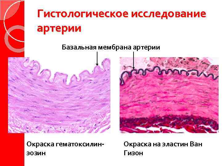Гистологическое исследование артерии Базальная мембрана артерии Окраска гематоксилинэозин Окраска на эластин Ван Гизон 