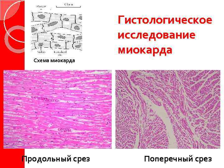 Схема миокарда Продольный срез Гистологическое исследование миокарда Поперечный срез 