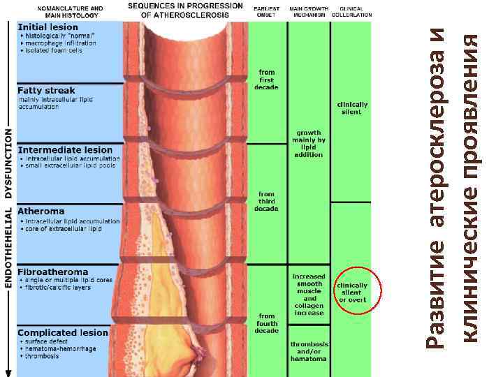 Развитие атеросклероза и клинические проявления 
