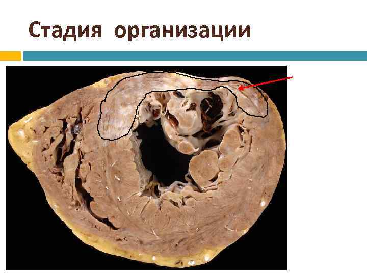 Стадия организации 