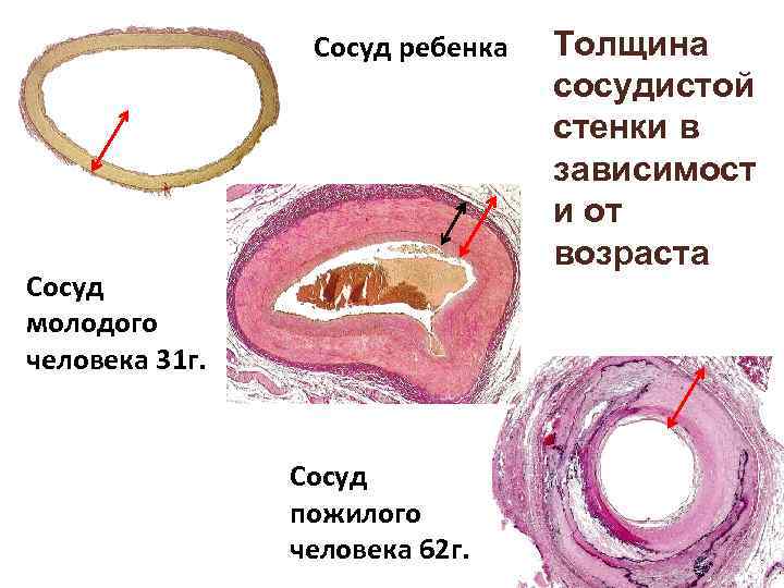 Сосуды человека фото