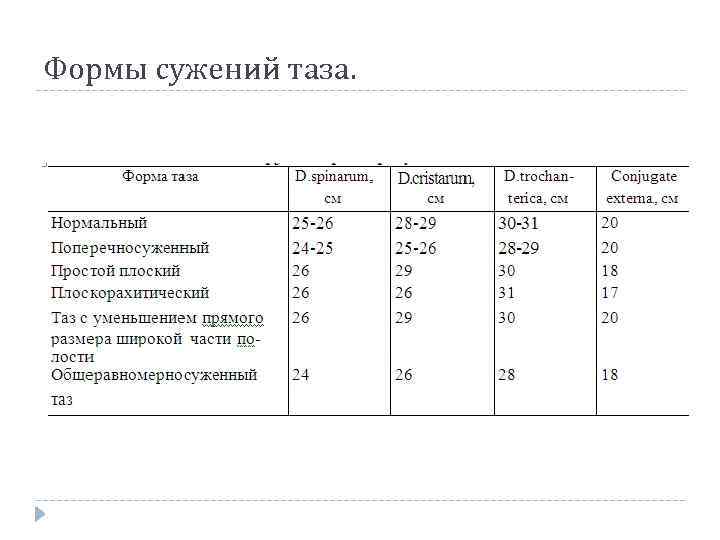 Узкий таз при беременности