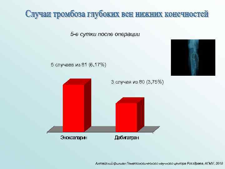 5 -е сутки после операции 5 случаев из 81 (6, 17%) 3 случая из