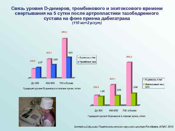 Связь уровня D-димеров, тромбинового и эхитоксового времени свертывания на 5 сутки после артропластики тазобедренного
