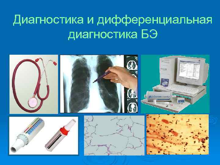 Диагностика и дифференциальная диагностика БЭ 