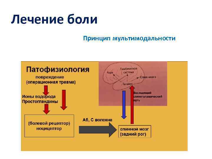 Лечение боли Принцип мультимодальности 