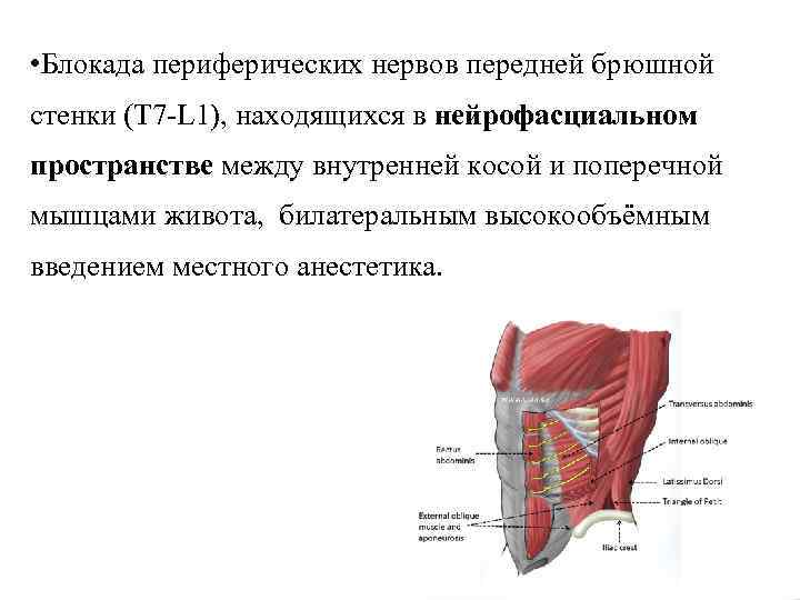  • Блокада периферических нервов передней брюшной стенки (Т 7 -L 1), находящихся в