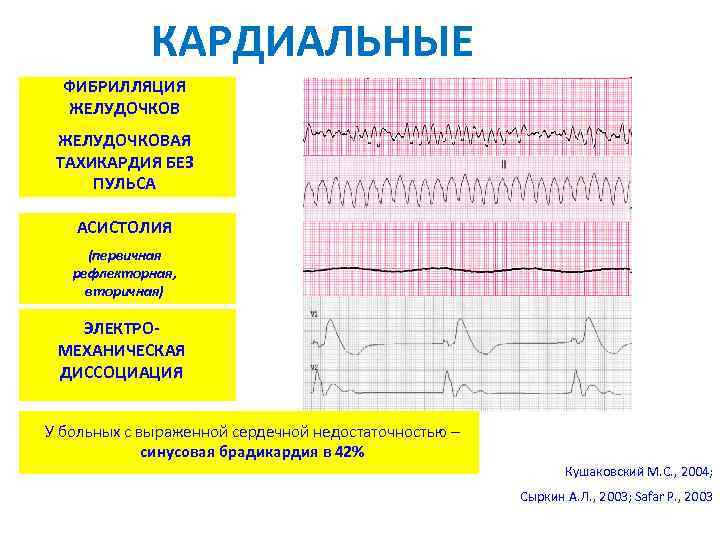 КАРДИАЛЬНЫЕ ФИБРИЛЛЯЦИЯ ЖЕЛУДОЧКОВАЯ ТАХИКАРДИЯ БЕЗ ПУЛЬСА АСИСТОЛИЯ (первичная рефлекторная, вторичная) ЭЛЕКТРОМЕХАНИЧЕСКАЯ ДИССОЦИАЦИЯ У больных