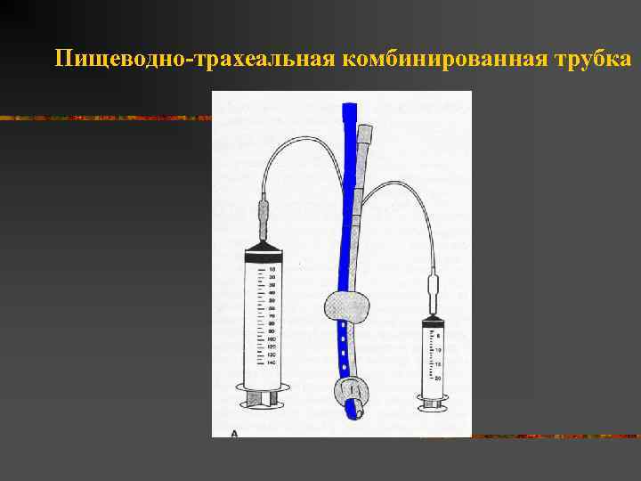 Пищеводно-трахеальная комбинированная трубка 