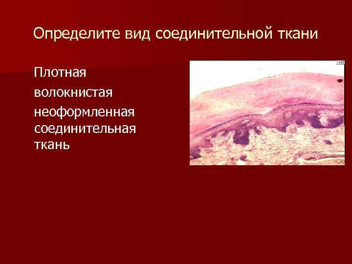 Определите вид соединительной ткани Плотная волокнистая неоформленная соединительная ткань 