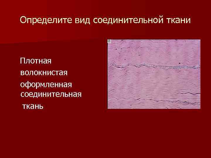 Определите вид соединительной ткани Плотная волокнистая оформленная соединительная ткань 
