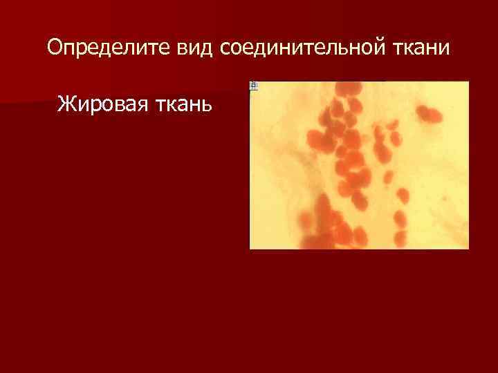 Определите вид соединительной ткани Жировая ткань 