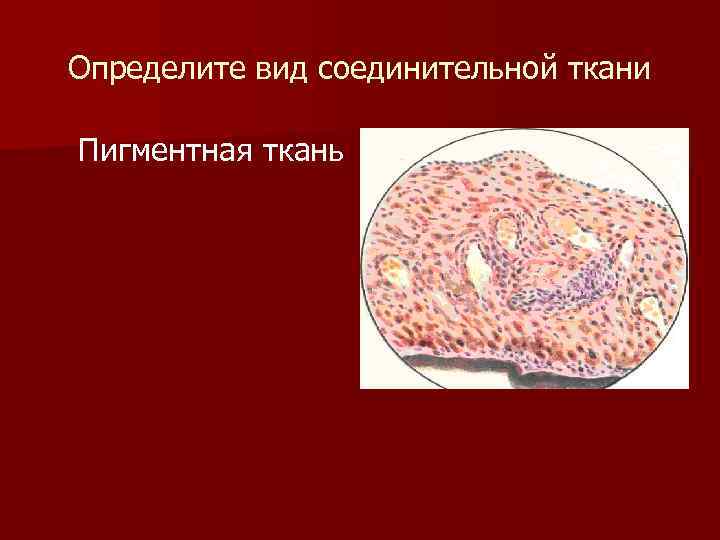 Определите вид соединительной ткани Пигментная ткань 