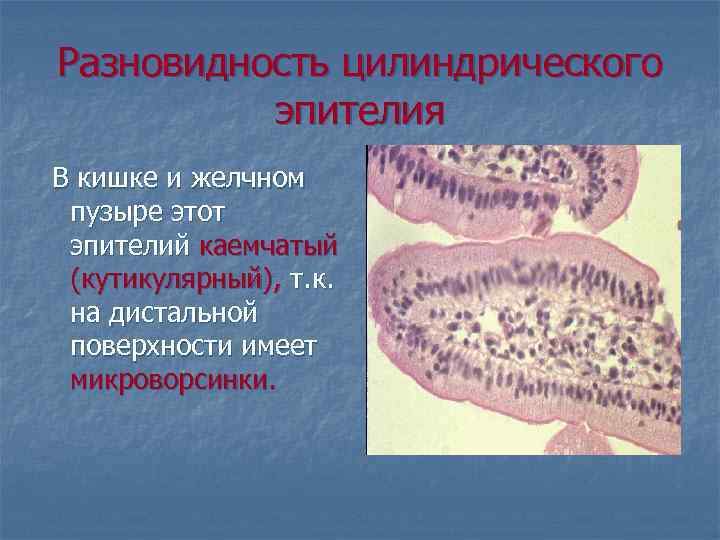 Разновидность цилиндрического эпителия В кишке и желчном пузыре этот эпителий каемчатый (кутикулярный), т. к.