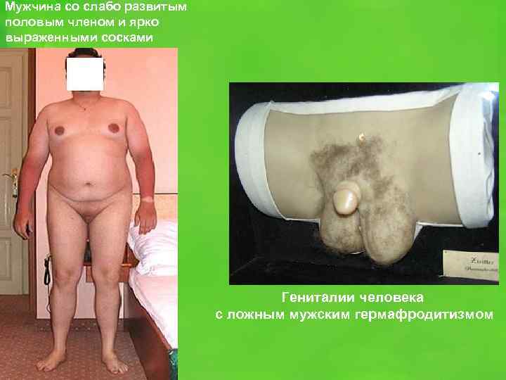 Мужчина со слабо развитым половым членом и ярко выраженными сосками Гениталии человека с ложным