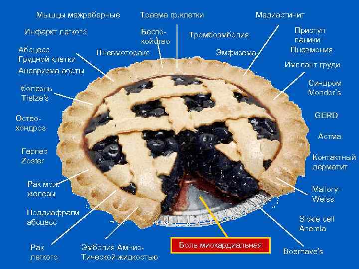 Мышцы межреберные Инфаркт легкого Абсцесс Грудной клетки Аневризма аорты Травма гр. клетки Беспокойство Пневмоторакс