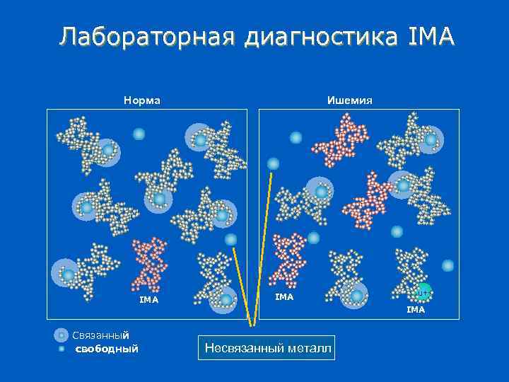 Лабораторная диагностика IMA Норма IMA Связанный свободный Ишемия IMA Cu++ IMA Несвязанный металл 