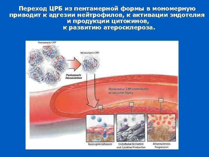 Переход ЦРБ из пентамерной формы в мономерную приводит к адгезии нейтрофилов, к активации эндотелия