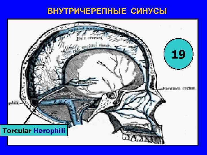 ВНУТРИЧЕРЕПНЫЕ СИНУСЫ 19 Torcular Herophili 