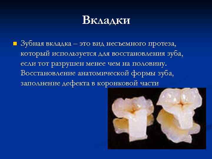 Вкладки n Зубная вкладка – это вид несъемного протеза, который используется для восстановления зуба,