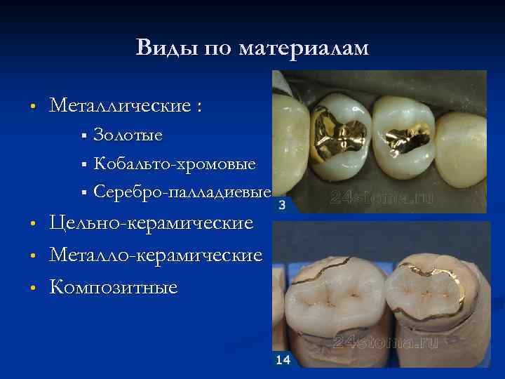 Виды по материалам • Металлические : Золотые § Кобальто-хромовые § Серебро-палладиевые § • •