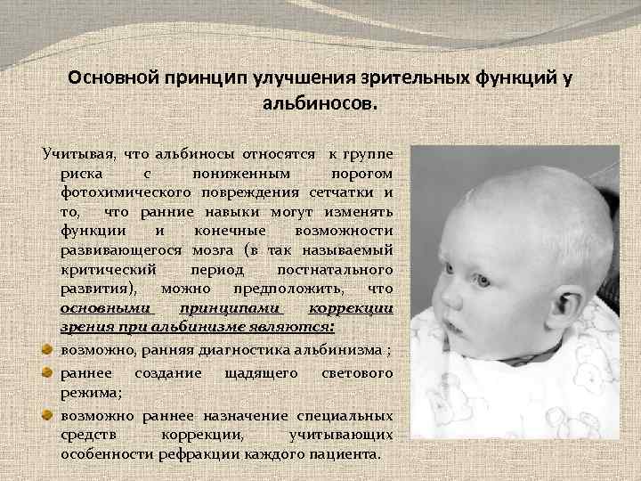 Основной принцип улучшения зрительных функций у альбиносов. Учитывая, что альбиносы относятся к группе риска