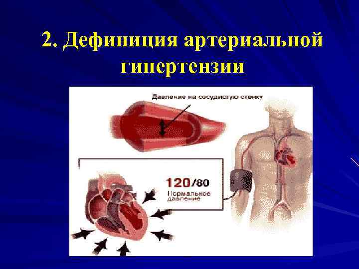 Артериальная гипертензия карта вызова шпаргалка