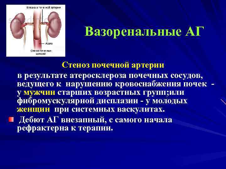 Вазоренальные АГ Стеноз почечной артерии в результате атеросклероза почечных сосудов, ведущего к нарушению кровоснабжения
