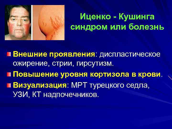 Иценко - Кушинга синдром или болезнь Внешние проявления: диспластическое ожирение, стрии, гирсутизм. Повышение уровня