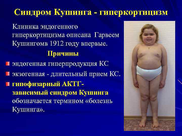 Синдром Кушинга - гиперкортицизм Клиника эндогенного гиперкортицизма описана Гарвеем Кушингомв 1912 году впервые. Причины