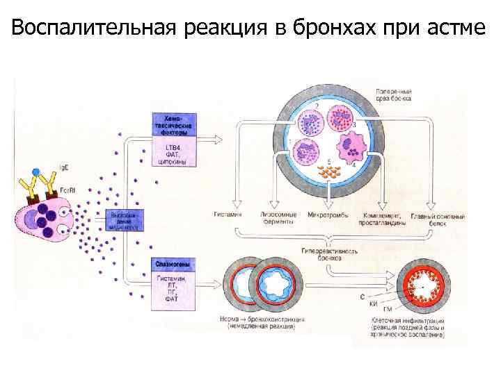 Схемы воспалительную реакцию тканей на внедрение микробов