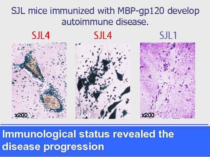 SJL mice immunized with MBP-gp 120 develop autoimmune disease. Immunological status revealed the disease