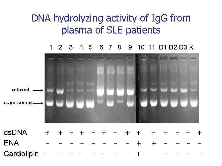 DNA hydrolyzing activity of Ig. G from plasma of SLE patients 1 2 3