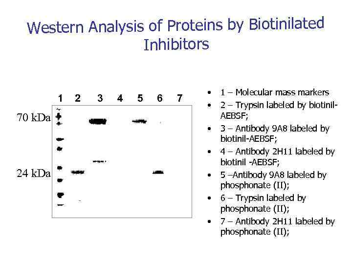 Western Analysis of Proteins by Biotinilated Inhibitors 1 70 k. Da 2 3 4